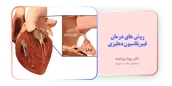 روش های درمان فیبریلاسیون دهلیزی