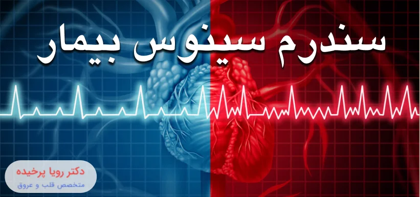 سندرم سینوس بیمار