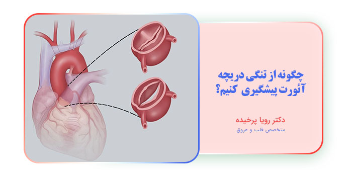 چگونه از تنگی دریچه آئورت پیشگیری کنیم؟