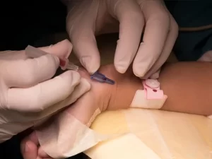عوارض آنژیوگرافی قلب