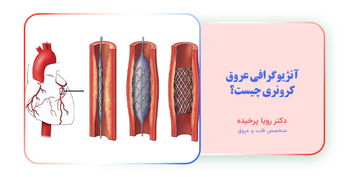آنژیوگرافی عروق کرونری چیست؟