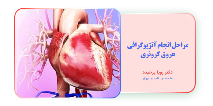 مراحل انجام آنژیوگرافی عروق کرونری